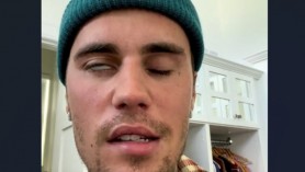 „Furtuna îngrozitoare cu care mă confrunt". Un nou mesaj al lui Bieber, la câteva zile după ce a arătat că nu-și poate mișca fața